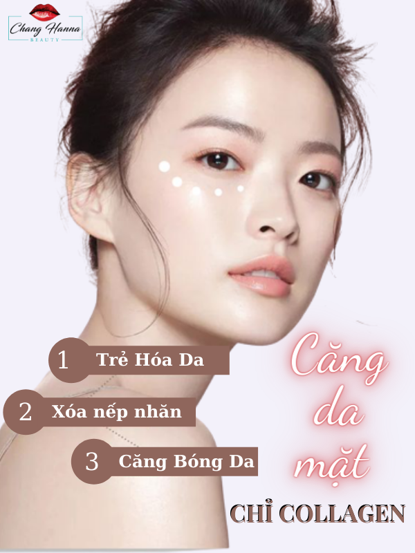 Ưu điểm của căng da mặt bằng chỉ